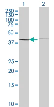 Western blot - Bag5 overexpression 293T lysate (whole cell) (AB94322)