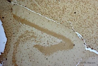 Immunohistochemistry (Formalin/PFA-fixed paraffin-embedded sections) - Anti-BAI1 antibody (AB135907)