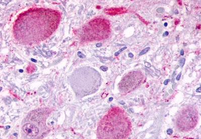 Immunohistochemistry (Formalin/PFA-fixed paraffin-embedded sections) - Anti-BAI3 antibody - C-terminal (AB189121)