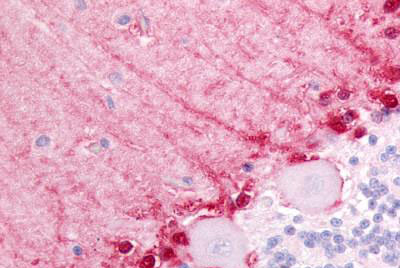 Immunohistochemistry (Formalin/PFA-fixed paraffin-embedded sections) - Anti-BAI3 antibody - N-terminal (AB188788)