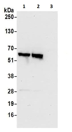 Western blot - Anti-BAIAP2L1/IRTKS antibody (AB226344)