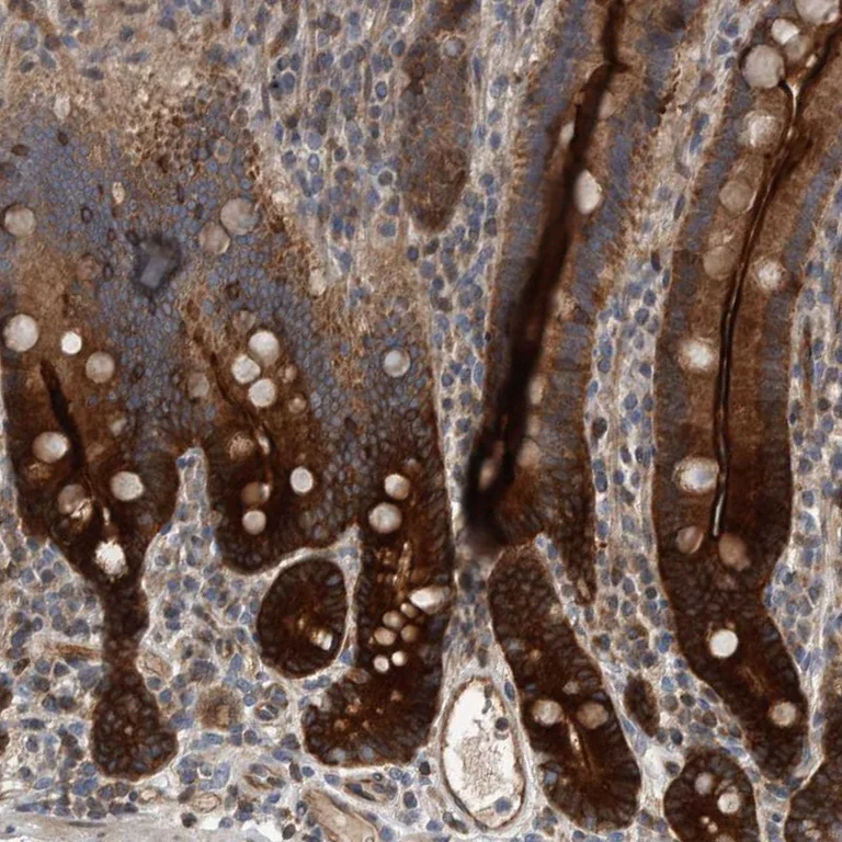 Immunohistochemistry (Formalin/PFA-fixed paraffin-embedded sections) - Anti-BAIAP2L1/IRTKS antibody (AB251753)