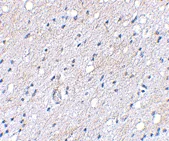 Immunohistochemistry (Formalin/PFA-fixed paraffin-embedded sections) - Anti-BAIAP3 antibody (AB106358)