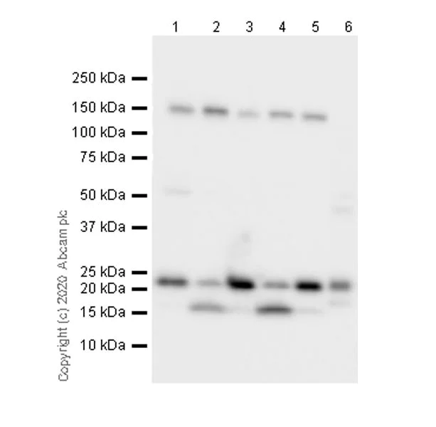 Western blot - Anti-Bak antibody [7D10] (AB243151)