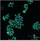Immunocytochemistry/ Immunofluorescence - Anti-Bak antibody (AB69404)