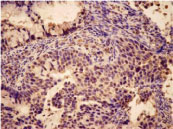 Immunohistochemistry (Formalin/PFA-fixed paraffin-embedded sections) - Anti-Bak antibody (AB69404)