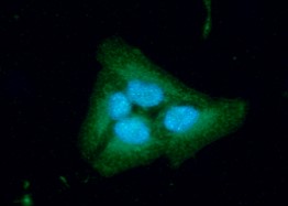 Immunocytochemistry/ Immunofluorescence - Anti-Bak antibody [AT38E2] (AB104124), expandable thumbnail