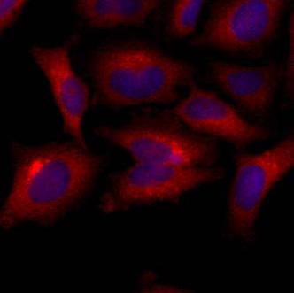 Immunocytochemistry/ Immunofluorescence - Anti-Bak antibody [AT38E2] (ab104124), expandable thumbnail