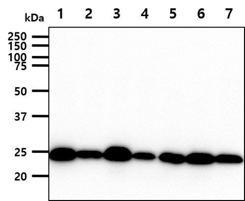Western blot - Anti-Bak antibody [AT38E2] (AB104124), expandable thumbnail