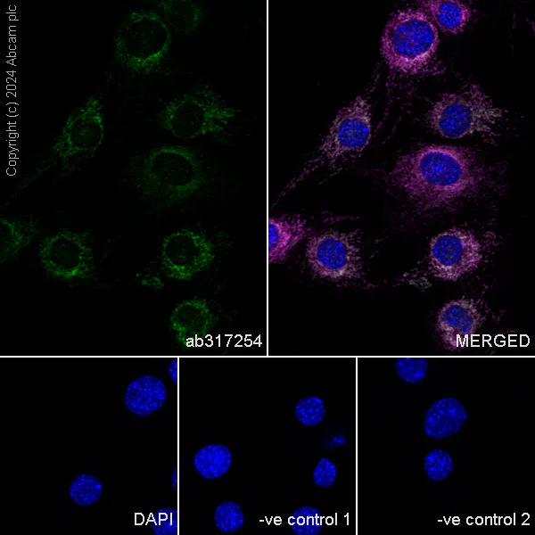 Immunocytochemistry/ Immunofluorescence - Anti-Bak antibody [EPR27487-15] (AB317254)