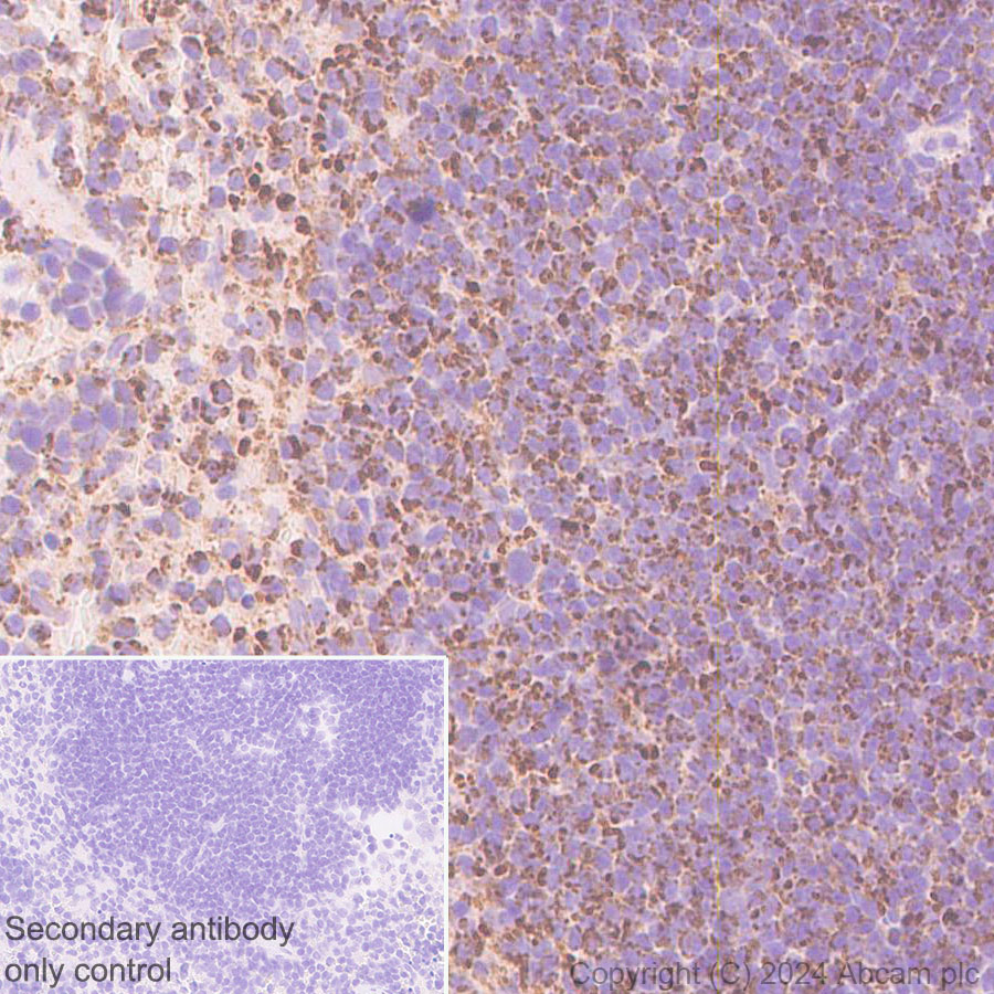 Immunohistochemistry (Formalin/PFA-fixed paraffin-embedded sections) - Anti-Bak antibody [EPR27487-15] (AB317254), expandable thumbnail