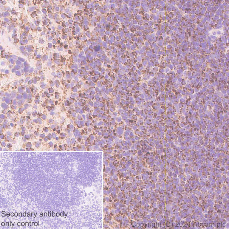 Immunohistochemistry (Formalin/PFA-fixed paraffin-embedded sections) - Anti-Bak antibody [EPR27487-15] (AB317254)