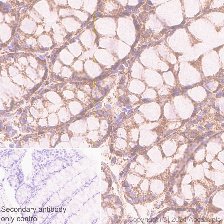 Immunohistochemistry (Formalin/PFA-fixed paraffin-embedded sections) - Anti-Bak antibody [EPR27487-15] (AB317254), expandable thumbnail