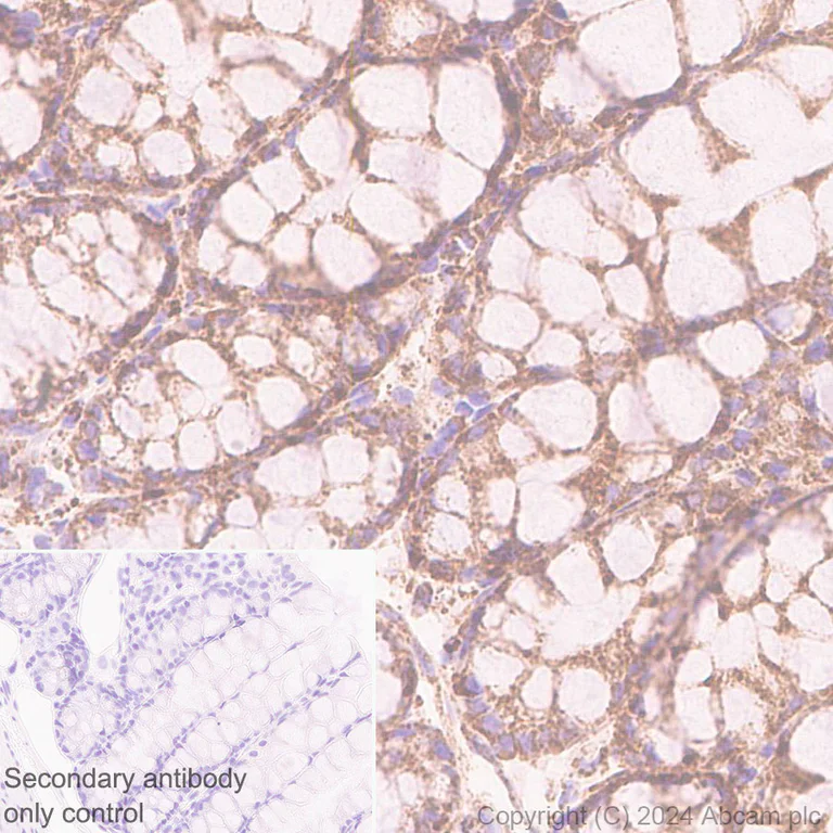 Immunohistochemistry (Formalin/PFA-fixed paraffin-embedded sections) - Anti-Bak antibody [EPR27487-15] (AB317254)
