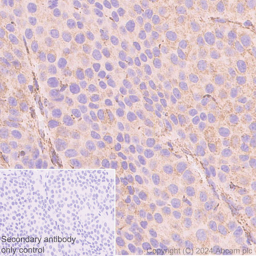 Immunohistochemistry (Formalin/PFA-fixed paraffin-embedded sections) - Anti-Bak antibody [EPR27487-15] (AB317254), expandable thumbnail