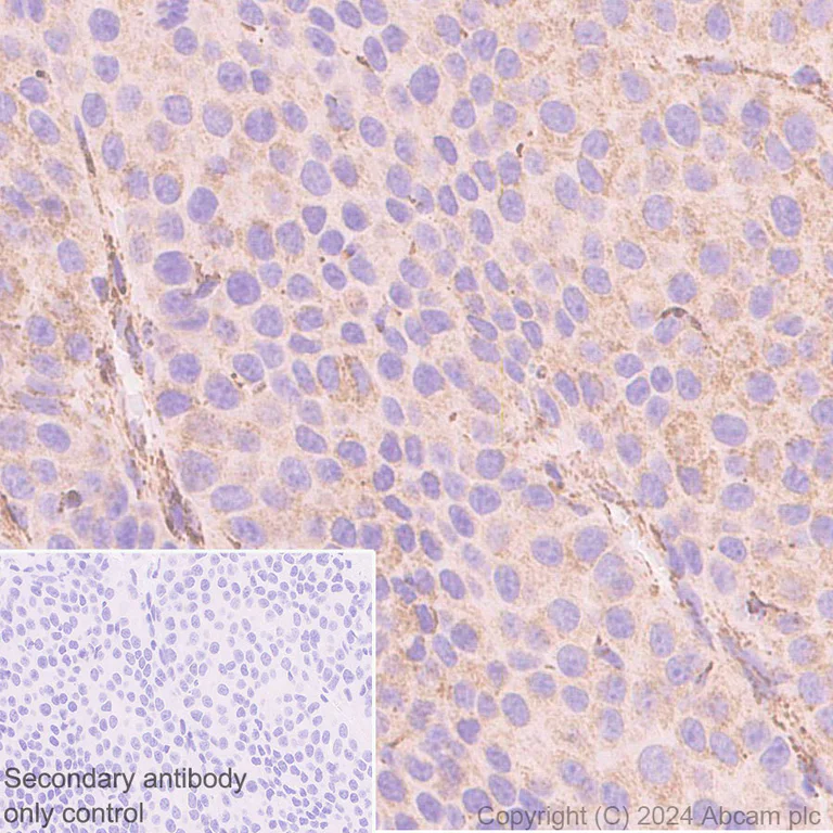 Immunohistochemistry (Formalin/PFA-fixed paraffin-embedded sections) - Anti-Bak antibody [EPR27487-15] (AB317254)