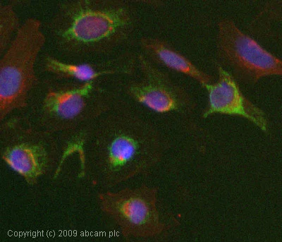 Immunocytochemistry/ Immunofluorescence - Anti-Bak antibody [Y164] (AB32371)
