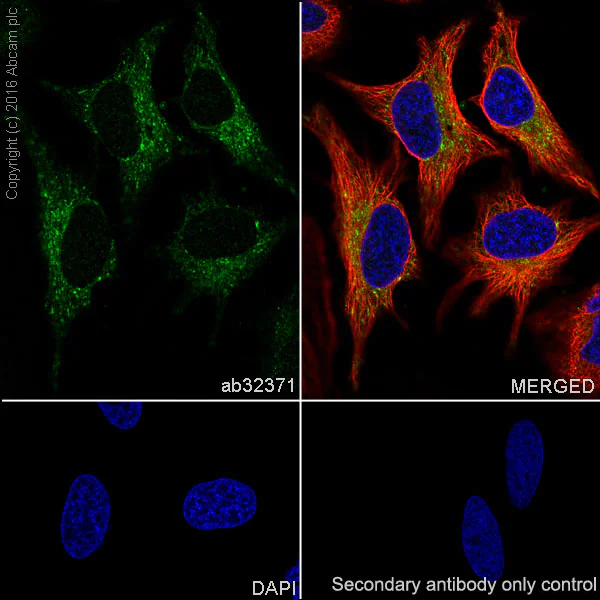 Immunocytochemistry/ Immunofluorescence - Anti-Bak antibody [Y164] (AB32371)