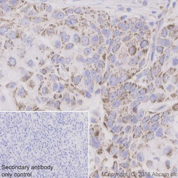 Immunohistochemistry (Formalin/PFA-fixed paraffin-embedded sections) - Anti-Bak antibody [Y164] (AB32371)
