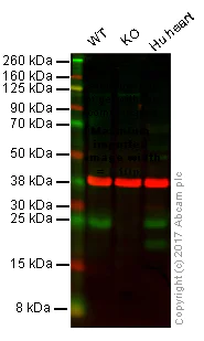 Western blot - Anti-Bak antibody [Y164] (AB32371)