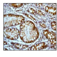 Immunohistochemistry (Formalin/PFA-fixed paraffin-embedded sections) - Anti-Bak antibody [Y164] - BSA and Azide free (AB220790)