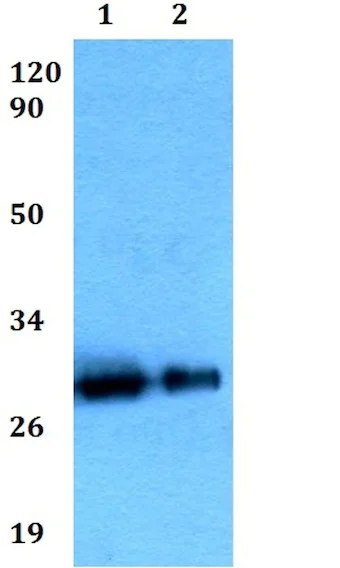 Western blot - Anti-BAMBI/NMA antibody (AB200737)
