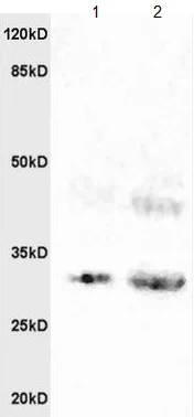 Western blot - Anti-BAMBI/NMA antibody (AB203070)