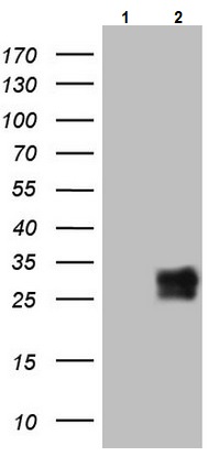 Western blot - Anti-BAMBI/NMA antibody [OTI5D5] (AB236499)
