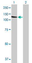 Western blot - Anti-Band 3/AE 1 antibody (AB172129)