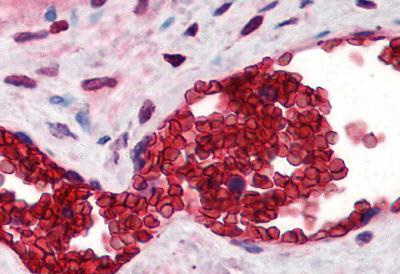 Immunohistochemistry (Formalin/PFA-fixed paraffin-embedded sections) - Anti-Band 3/AE 1 antibody (AB78067)