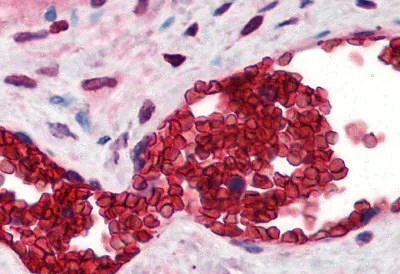 Immunohistochemistry (Formalin/PFA-fixed paraffin-embedded sections) - Anti-Band 3/AE 1 antibody (AB78067)