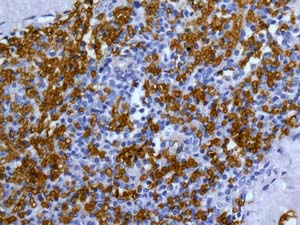 Immunohistochemistry (Formalin/PFA-fixed paraffin-embedded sections) - Anti-Band 3/AE 1 antibody [EPR1425(2)] (AB175214)