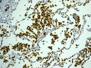 Immunohistochemistry (Formalin/PFA-fixed paraffin-embedded sections) - Anti-Band 3/AE 1 antibody [EPR1425(2)] - BSA and Azide free (AB249866)