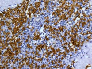 Immunohistochemistry (Formalin/PFA-fixed paraffin-embedded sections) - Anti-Band 3/AE 1 antibody [EPR1425(2)] - BSA and Azide free (AB249866)