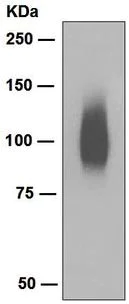 Western blot - Anti-Band 3/AE 1 antibody [EPR1426] (AB108414)