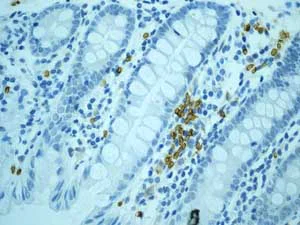 Immunohistochemistry (Formalin/PFA-fixed paraffin-embedded sections) - Anti-Band 3/AE 1 antibody [EPR1426] - BSA and Azide free (AB236016)