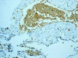 Immunohistochemistry (Formalin/PFA-fixed paraffin-embedded sections) - Anti-Band 3/AE 1 antibody [EPR1426] - BSA and Azide free (AB236016)