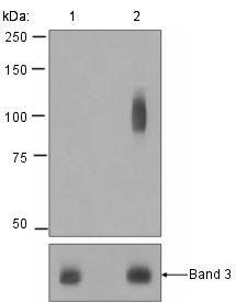 Western blot - Anti-Band 3/AE 1 (phospho Y21) antibody [EPR1424] (AB125070)