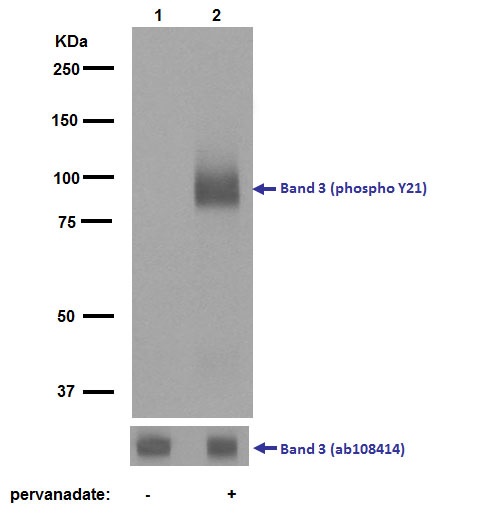 Anti-Band 3/AE 1 (phospho Y21) antibody [EPR1424] (AB125070) | Abcam ...