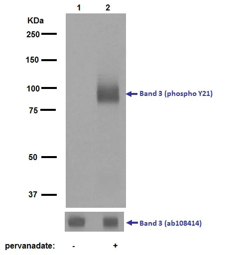 Western blot - Anti-Band 3/AE 1 (phospho Y21) antibody [EPR1424] (AB125070)