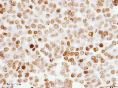 Immunohistochemistry (Formalin/PFA-fixed paraffin-embedded sections) - Anti-BANF1/BAF antibody [EPR7668] - BSA and Azide free (AB240953), expandable thumbnail