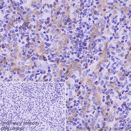 Immunohistochemistry (Formalin/PFA-fixed paraffin-embedded sections) - Anti-BANK1 antibody [EPR20788] - BSA and Azide free (AB230492), expandable thumbnail