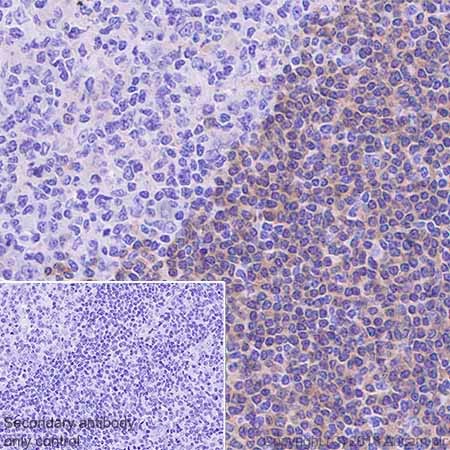 Immunohistochemistry (Formalin/PFA-fixed paraffin-embedded sections) - Anti-BANK1 antibody [EPR20788] - BSA and Azide free (AB230492), expandable thumbnail