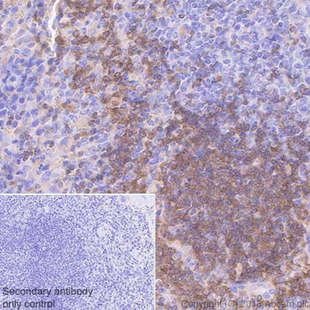 Immunohistochemistry (Formalin/PFA-fixed paraffin-embedded sections) - Anti-BANK1 antibody [EPR20795] - BSA and Azide free (AB230493)