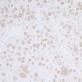 Immunohistochemistry (Formalin/PFA-fixed paraffin-embedded sections) - Anti-BANP antibody (AB72076), expandable thumbnail