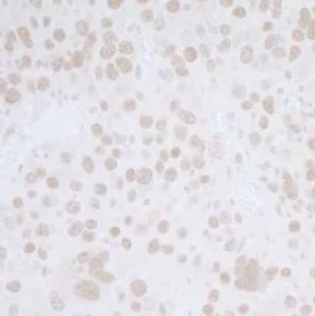 Immunohistochemistry (Formalin/PFA-fixed paraffin-embedded sections) - Anti-BANP antibody (AB72076)
