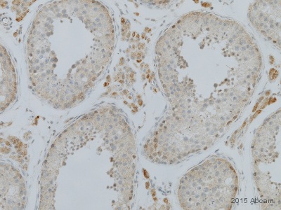 Immunohistochemistry (Formalin/PFA-fixed paraffin-embedded sections) - Anti-BAP1 antibody (AB199396)