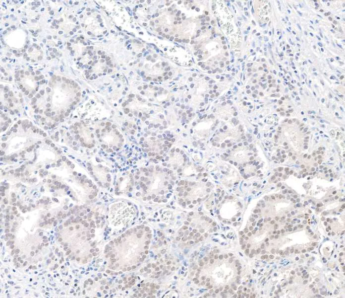 Immunohistochemistry (Formalin/PFA-fixed paraffin-embedded sections) - Anti-BAP1 antibody (AB245391)