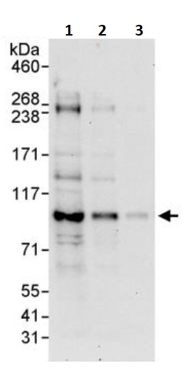 Western blot - Anti-BAP1 antibody (AB245391)