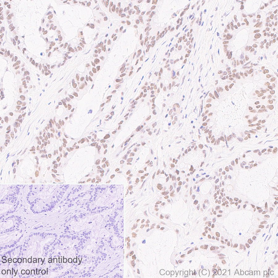 Immunohistochemistry (Formalin/PFA-fixed paraffin-embedded sections) - Anti-BAP1 antibody [EPR22826-65] (AB255611), expandable thumbnail